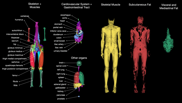 Organs on a MRI