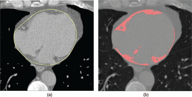 Thoracic Imaging