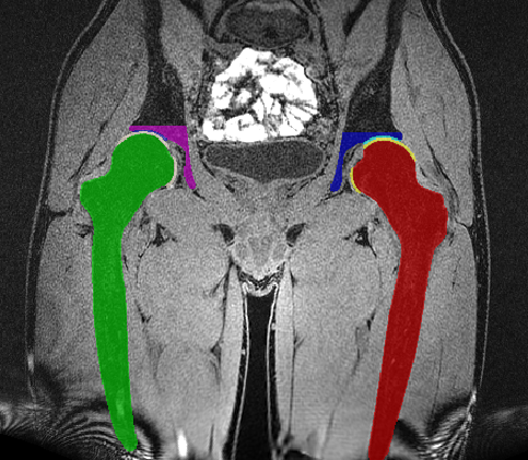 Musculoskeletal Imaging